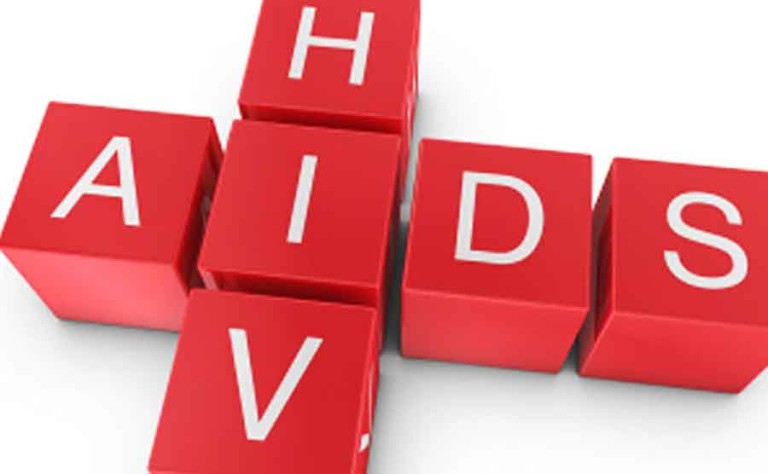 HIV Aids