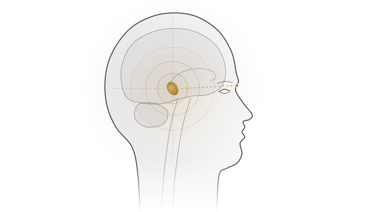 Side view of a human head with the pineal gland at the centre of the brain, level with the brow